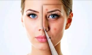 أنواع البشرة وأهم النصائح للتعامل معها